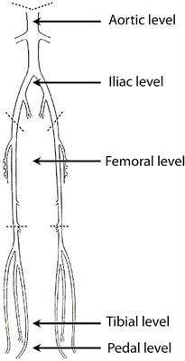 Computed Tomography Angiography in Peripheral Arterial Disease: Comparison of Three Image Acquisition Techniques to Optimize Vascular Enhancement—Randomized Controlled Trial